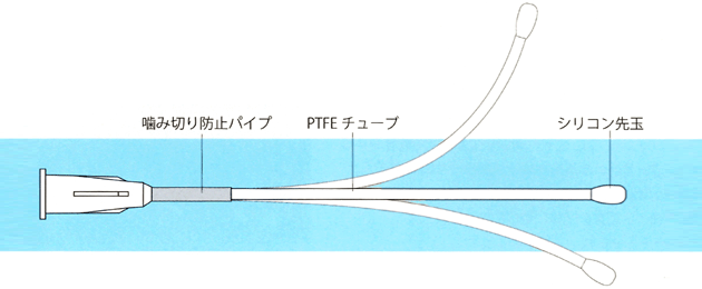 ステンレスタイプ